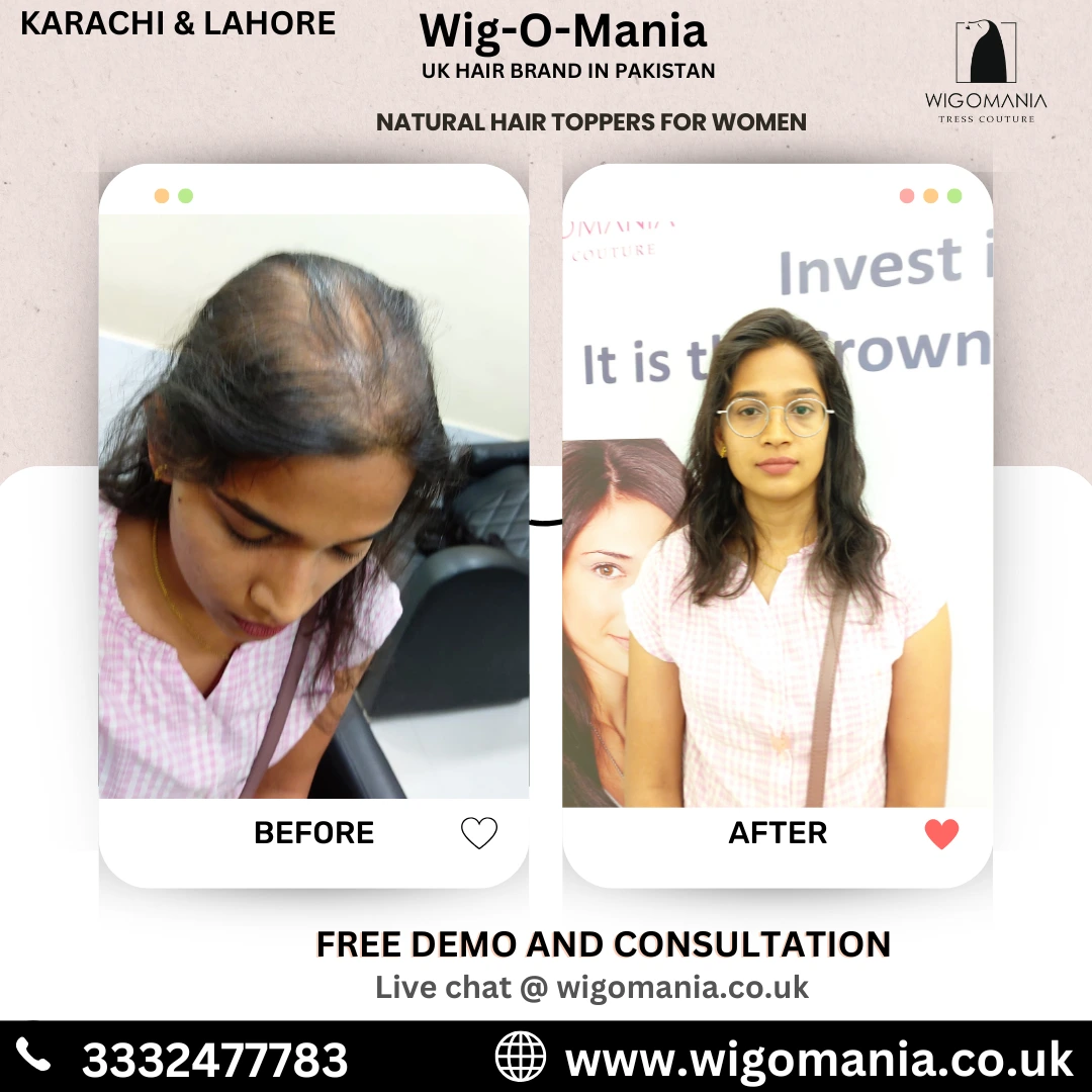 hair toppers for women in karachi & lahore